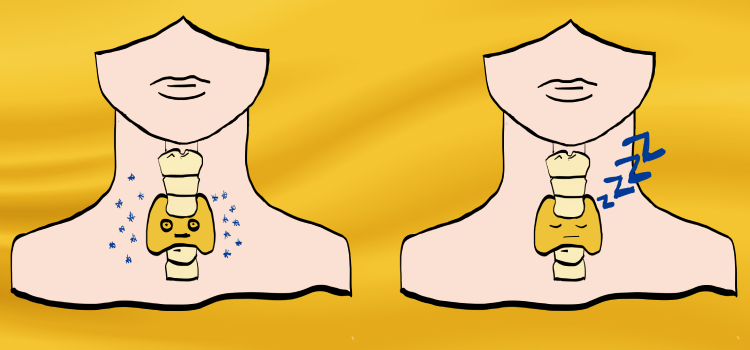 Diagnóstico y tratamiento integral de las enfermedades de la Glándula Tiroidess